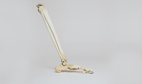 Osteoporóza - tichý zlodej kostí